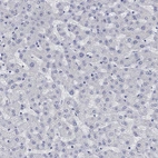 Immunohistochemical staining of human liver shows no positivity in hepatocytes as expected.