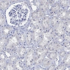 Immunohistochemical staining of human kidney shows no positivity in cells in tubules as expected.