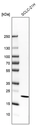 Western blot analysis in human cell line SCLC-21H.