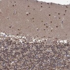 Anti-PCBP2 Antibody
