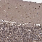 Anti-PCBP2 Antibody