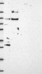 Lane 1: Marker [kDa] 250, 130, 95, 72, 55, 36, 28, 17, 10 | Lane 2: RT4 | Lane 3: U-251 MG | Lane 4: Human Plasma | Lane 5: Liver | Lane 6: Tonsil
