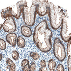 Anti-OCLN Antibody