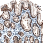 Immunohistochemical staining of human stomach shows strong positivity in apical membrane in glandular cells.