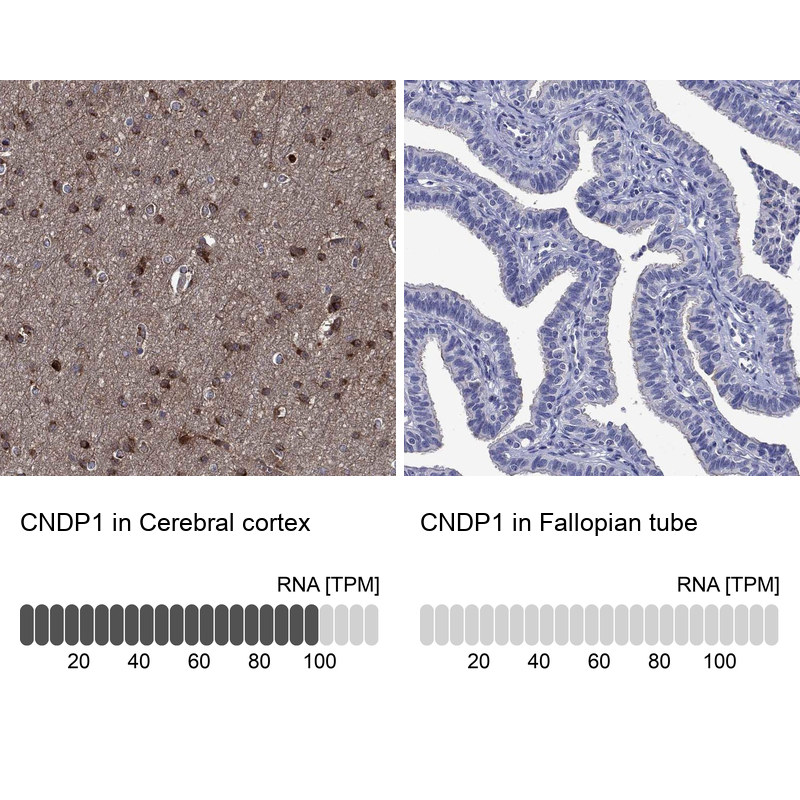 Anti-CNDP1 Antibody