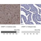 Anti-CNDP1 Antibody