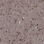 Immunohistochemical staining of human cerebral cortex shows high expression.