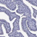 Anti-CNDP1 Antibody