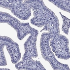 Immunohistochemical staining of human fallopian tube shows low expression as expected.