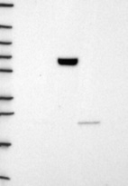 Anti-CNDP1 Antibody