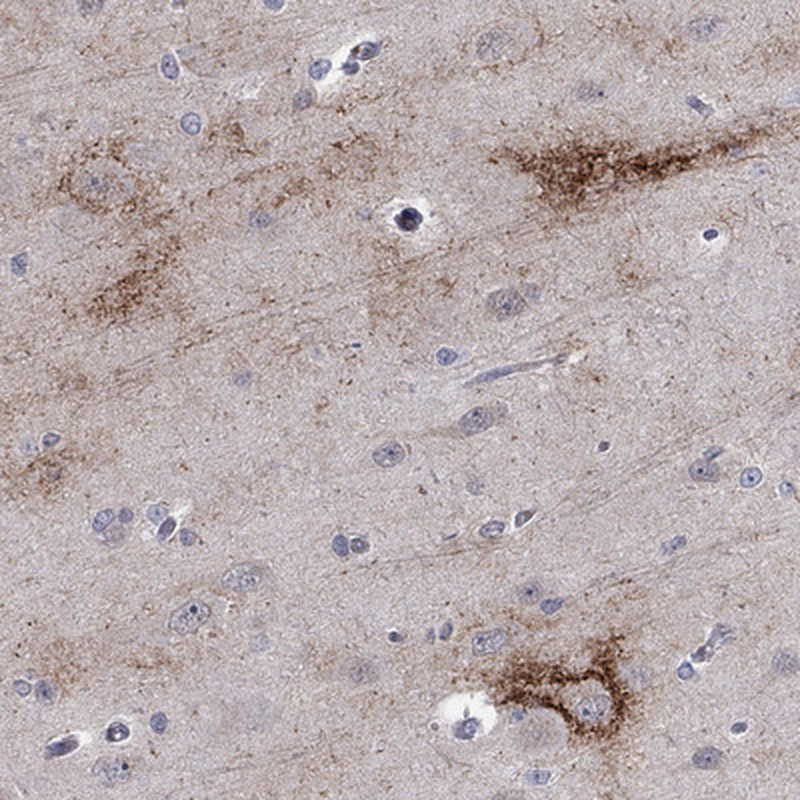 Anti-TTC21B Antibody