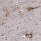 Anti-TTC21B Antibody