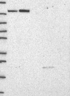 Lane 1: Marker [kDa] 250, 130, 95, 72, 55, 36, 28, 17, 10 | Lane 2: RT4 | Lane 3: U-251 MG | Lane 4: Human Plasma | Lane 5: Liver | Lane 6: Tonsil