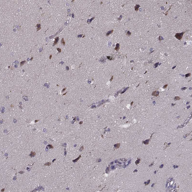Anti-PCDHA4 Antibody