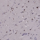 Anti-PCDHA4 Antibody