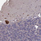 Immunohistochemical staining of human cerebellum shows strong cytoplasmic positivity in Purkinje cells.