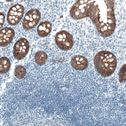 Immunohistochemical staining of human colon shows strong membranous positivity in glandular cells.