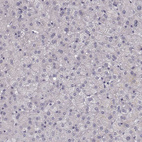 Immunohistochemical staining of human liver shows no cytoplasmic positivity in hepatocytes as expected.