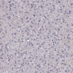 Immunohistochemical staining of human liver shows no cytoplasmic positivity in hepatocytes as expected.