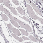 Immunohistochemical staining of human skeletal muscle shows no cytoplasmic positivity in myocytes as expected.