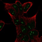 Anti-SESN1 Antibody