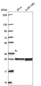 Anti-HMGB1 Antibody