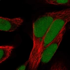 Immunofluorescent staining of human cell line Rh30 shows localization to nucleoplasm.