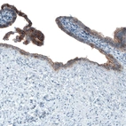 Immunohistochemical staining of human fallopian tube shows strong positivity in apical membrane in glandular cells.