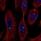 Immunofluorescent staining of human cell line SiHa shows localization to nucleoli.