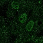 Anti-TAL1 Antibody