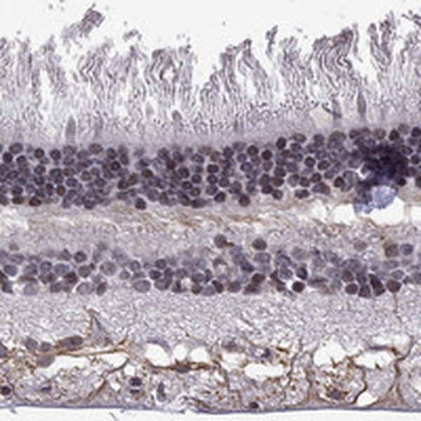 Anti-MTNR1B Antibody