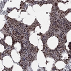 Anti-JMJD6 Antibody