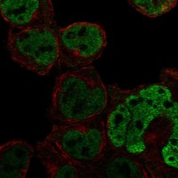 Anti-C1orf226 Antibody