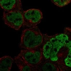 Anti-C1orf226 Antibody