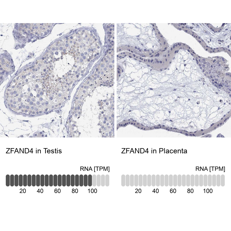 Anti-ZFAND4 Antibody