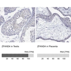 Anti-ZFAND4 Antibody