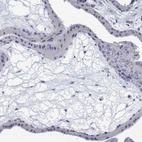 Immunohistochemical staining of human placenta shows low expression as expected.