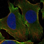 Anti-GPATCH1 Antibody