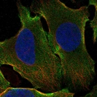 Anti-GPATCH1 Antibody
