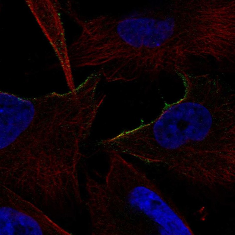 Anti-ADRA1B Antibody