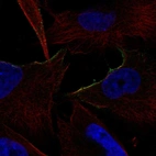 Anti-ADRA1B Antibody