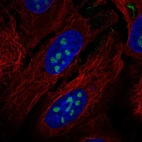 Immunofluorescent staining of human cell line U2OS shows localization to nucleoli.