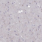 Immunohistochemical staining of human cerebral cortex shows high expression.