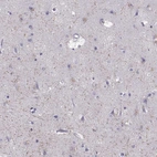 Immunohistochemical staining of human cerebral cortex shows high expression.