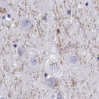 Immunohistochemical staining of human caudate shows moderate positivity in neuronal projections.