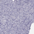 Immunohistochemical staining of human pancreas shows low expression as expected.