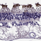 Immunohistochemical staining of human eye, retina shows moderate positivity in rods.