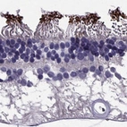 Immunohistochemical staining of human eye, retina shows moderate positivity in rods.