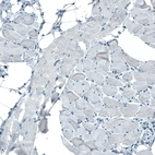 Immunohistochemical staining of human skeletal muscle shows no positivity in myocytes as expected.