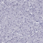 Immunohistochemical staining of human liver shows no positivity in hepatocytes as expected.